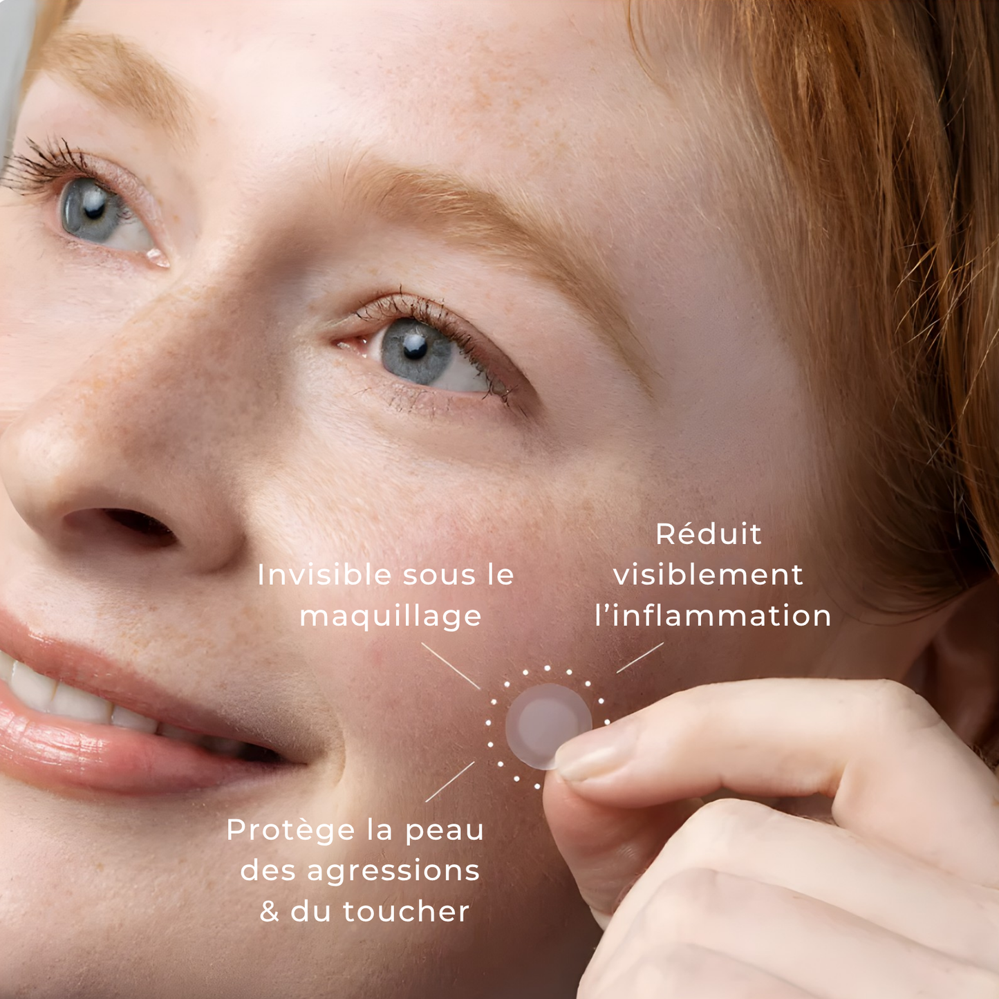 CycleClear® - Patchs Jour & Nuit pour l’Acné Hormonale