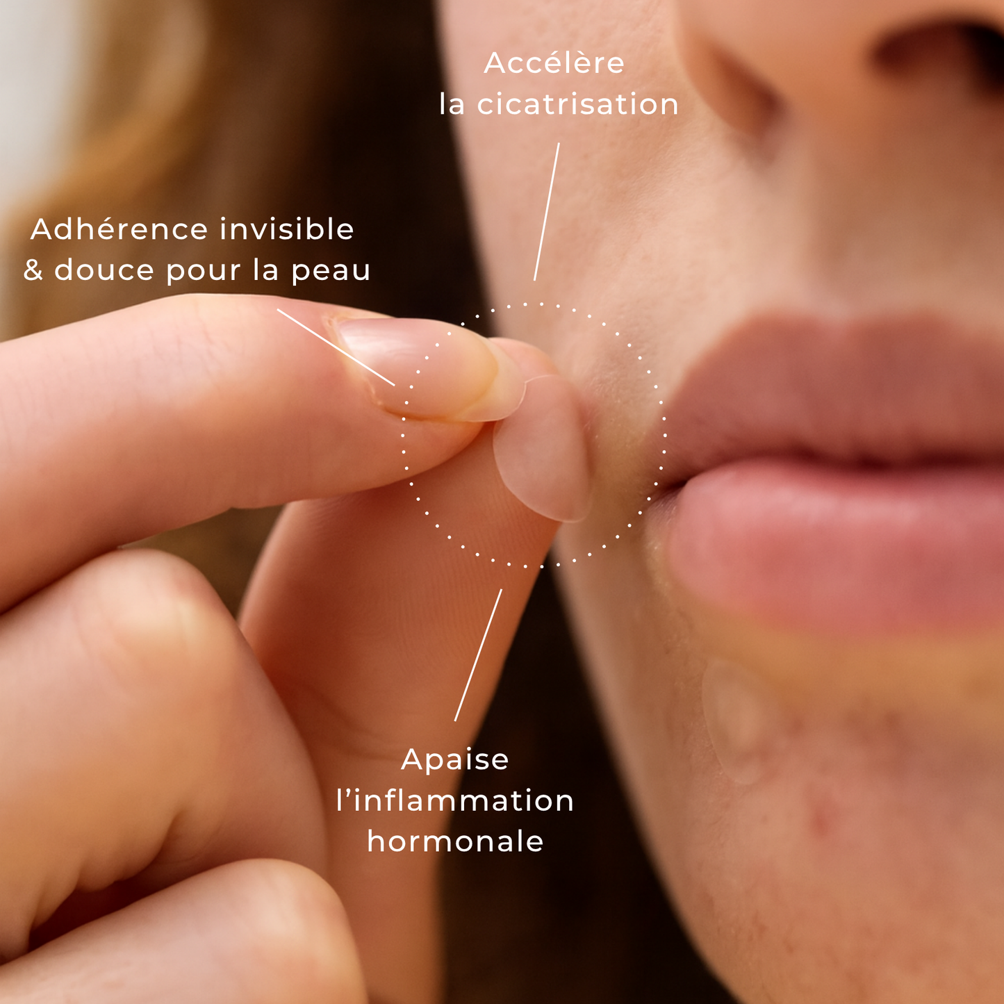 CycleClear® - Patchs Jour & Nuit pour l’Acné Hormonale