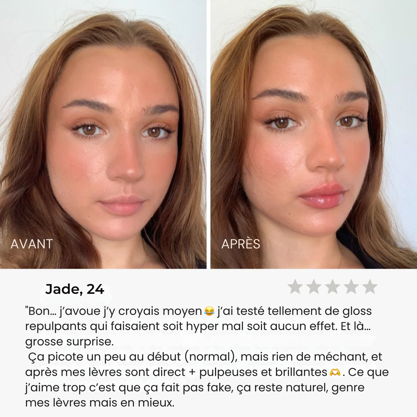 GlowLip® - Repulpeur Instantané Sans Injection