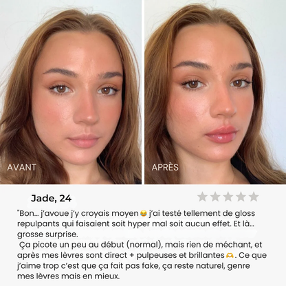 GlowLip® - Repulpeur Instantané Sans Injection