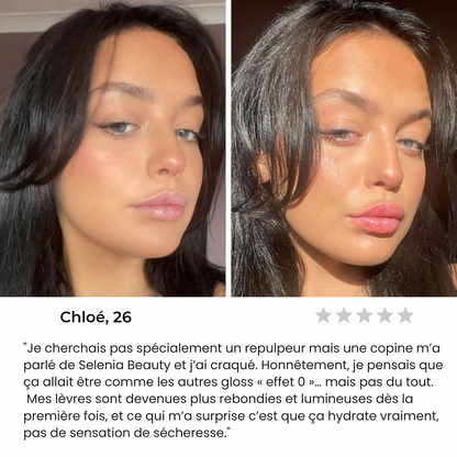 GlowLip® - Repulpeur Instantané Sans Injection