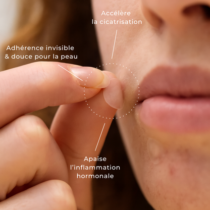 CycleClear® - Patchs Jour & Nuit pour l’Acné Hormonale